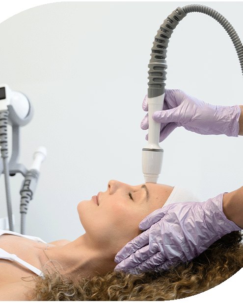 An RF microneedling treatment in progress